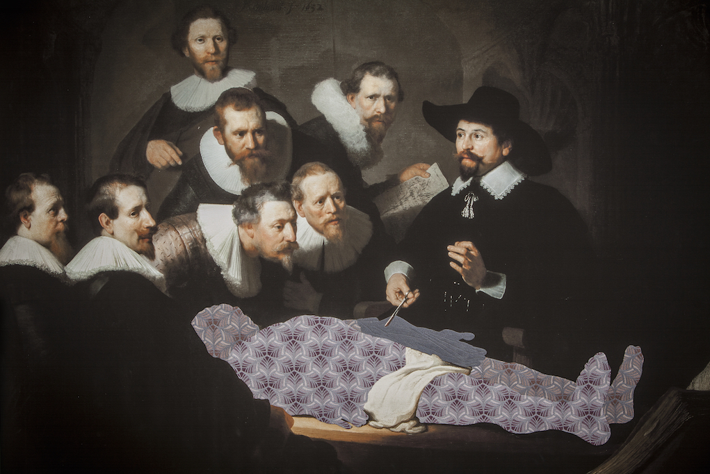 A group of bearded men wearing ruffled collars watches attentively as a man in a black hat cuts another man's arm with scissors. The victim, however, is only a patterned purple and gray abstraction.